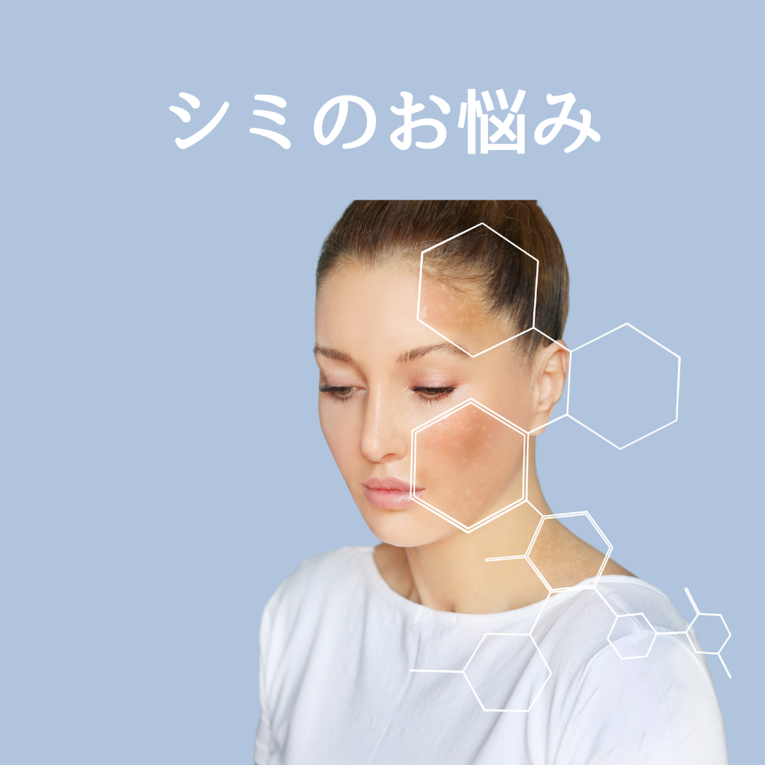 シミ